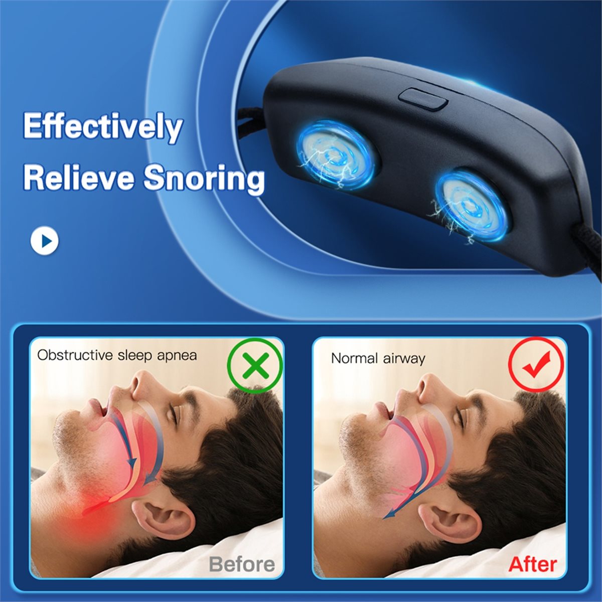 Trend Health And Wellness - 2026 Trend EMS Pulsgerät gegen Schnarchen,